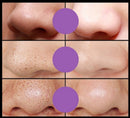 Removedor De Cravos Máscaras Faciais 50g
