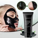 Removedor De Cravos Máscaras Faciais 50g